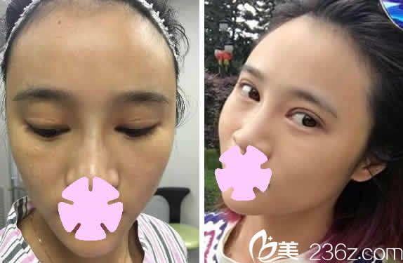 大同名仕整形打瘦臉多少錢？2019價(jià)格表及魯彥麟院長(zhǎng)案例搶先看