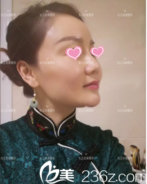 九江臺美治療案例