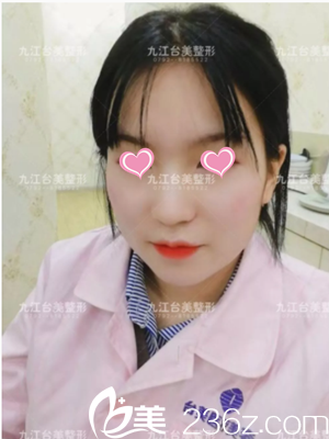 許院長(zhǎng)給我注射瘦臉3天了