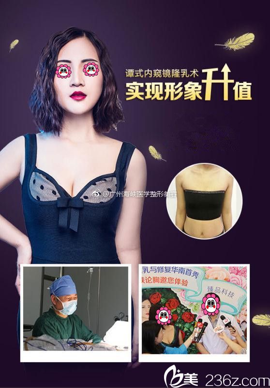 譚式內(nèi)窺鏡隆乳術(shù)前后對(duì)比圖 譚式內(nèi)窺鏡隆乳術(shù)前后對(duì)比圖