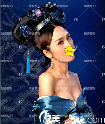 四川朗睿假體豐胸術(shù)后性感寫真 四川朗睿假體豐胸術(shù)后性感寫真