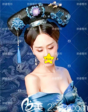 整形醫(yī)院盧剛假體豐胸真人案例：從A－到C＋，暴增回頭率