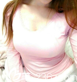 我找太原歐美蓮張世民做隆胸術(shù)后一個(gè)月的效果 我找太原歐美蓮張世民做隆胸術(shù)后一個(gè)月的效果