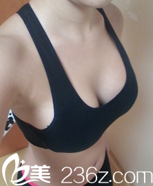 醫(yī)生哪個尺子和筆在我胸部畫線