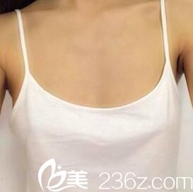 自體脂肪豐胸術(shù)前 自體脂肪豐胸術(shù)前