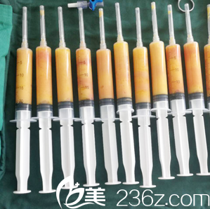 余恩旭醫(yī)生從我腿部抽出的脂肪 余恩旭醫(yī)生從我腿部抽出的脂肪