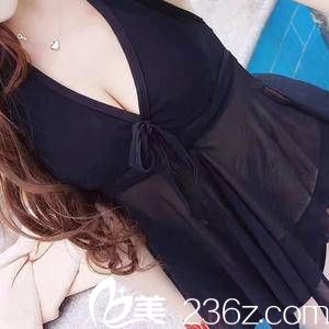 辣媽逆襲記 自體脂肪豐胸讓她成為挺翹佳人