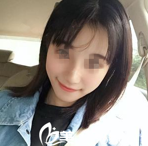 在南寧韓成做鼻綜合手術(shù)后10天