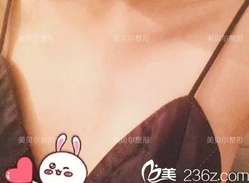 術(shù)前貧乳胸部一大一小 術(shù)前貧乳胸部一大一小