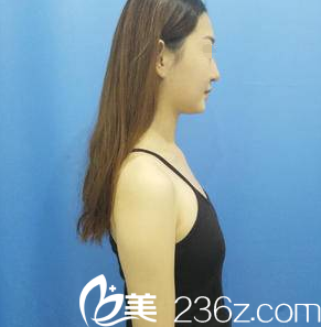 術(shù)前胸部扁平 術(shù)前胸部扁平