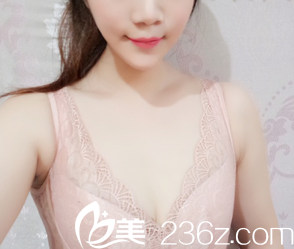 王沛森醫(yī)生給我做脂肪豐胸第11天效果 王沛森醫(yī)生給我做脂肪豐胸第11天效果