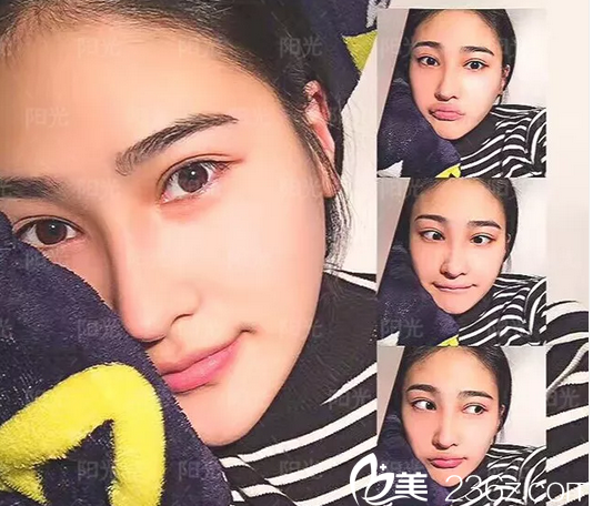 <!--<i data=20240703-sp></i>-->整形醫(yī)院做鼻子怎么樣 <!--<i data=20240703-sp></i>-->整形醫(yī)院做鼻子怎么樣