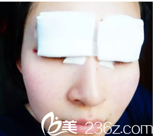 剛做完手術(shù)還貼著紗布的照片