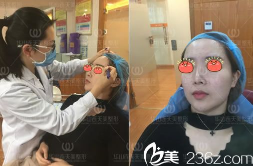 杭州醫(yī)院柳春紅面診過程