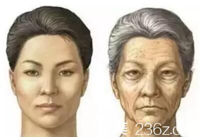 面部衰老皺紋叢生