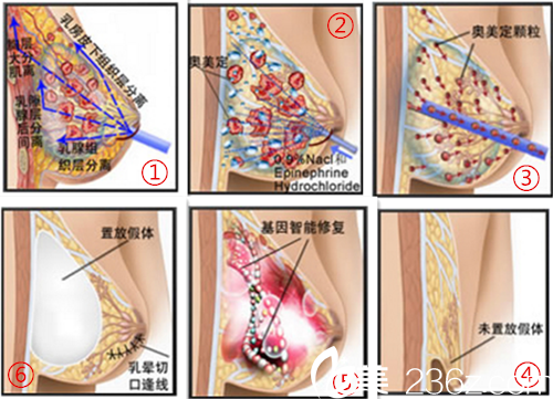 長(zhǎng)沙美研三位層離清奧技術(shù)流程圖解