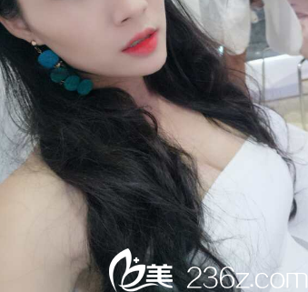 廣州藝美做自體脂肪隆胸怎么樣 廣州藝美做自體脂肪隆胸怎么樣