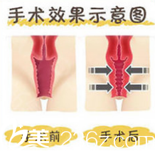 北京玲瓏梵宮手術(shù)縮陰道多少錢(qián)？私密整形特惠價(jià)格表來(lái)參考