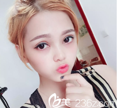 廣州曙光范丹做雙眼皮怎么樣 廣州曙光范丹做雙眼皮怎么樣