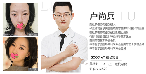 米蘭柏羽盧尚兵美杜莎雙眼皮案例 米蘭柏羽盧尚兵美杜莎雙眼皮案例