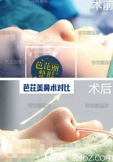 廣<!--<i data=20240703-sp></i>-->寧芭芘麗鼻綜合<span style=