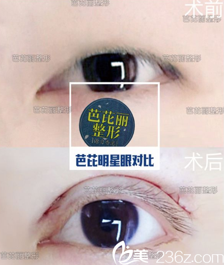 廣<!--<i data=20240703-sp></i>-->寧芭芘麗眼綜合<span style=