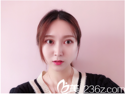 廣州紫馨李政祐做雙眼皮怎么樣 廣州紫馨李政祐做雙眼皮怎么樣