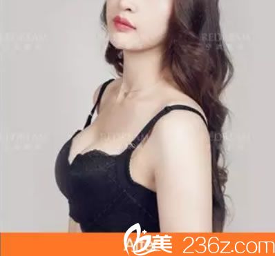 寧波薇琳娜綺麗假體隆胸<span style=