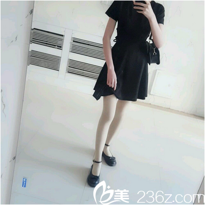 廣州美萊張毓吸脂怎么樣