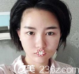 手術(shù)當(dāng)天 手術(shù)當(dāng)天