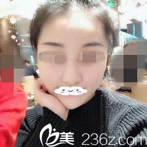 手術(shù)前的我 手術(shù)前的我