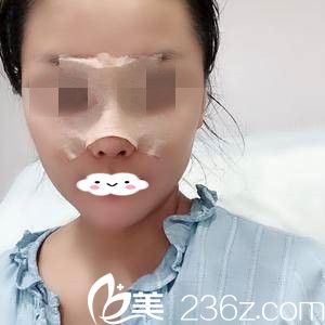 術(shù)后當(dāng)天 術(shù)后當(dāng)天