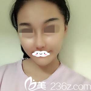 術(shù)后一周的我 術(shù)后一周的我