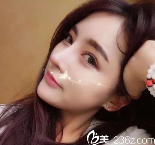 羅志敏做的鼻子案例 羅志敏做的鼻子案例