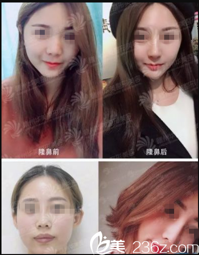 2018年贛州華美年終答謝會盛典特惠來襲，全線1折起，假體+耳軟骨鼻綜合特價優(yōu)惠，到院送脫毛/光子嫩膚/私密SPA任選