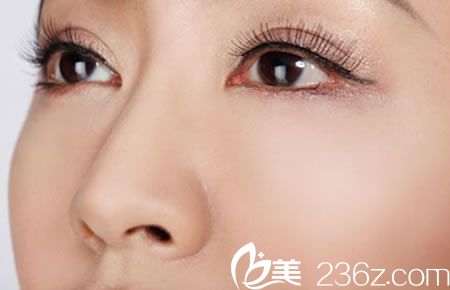 寧波米陽整形醫(yī)院做雙眼皮多少錢?曹英武院長主刀雙眼皮手術價格2000元你說貴不貴