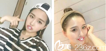 一周后樣子 一周后樣子