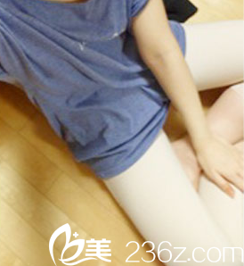 在北京惠合嘉美做水動力腿部吸脂第13天效果 在北京惠合嘉美做水動力腿部吸脂第13天效果