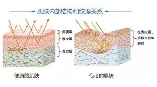 面部皺紋不知道怎么改善？長(zhǎng)春張曼2019年整形優(yōu)惠熱瑪吉僅需6400元