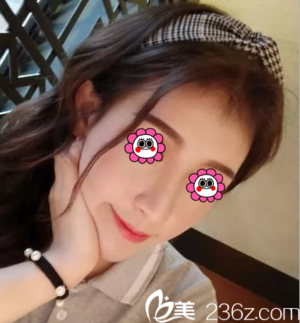 自體脂肪面部填充會有硬塊嗎？我在北京惠合嘉美塑美經(jīng)歷告訴你