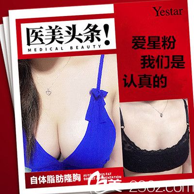 溫州藝星自體脂肪隆胸前后變化圖