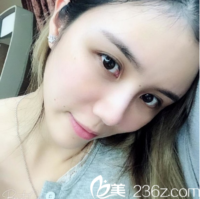 廣州哪家醫(yī)院做脂肪填充好