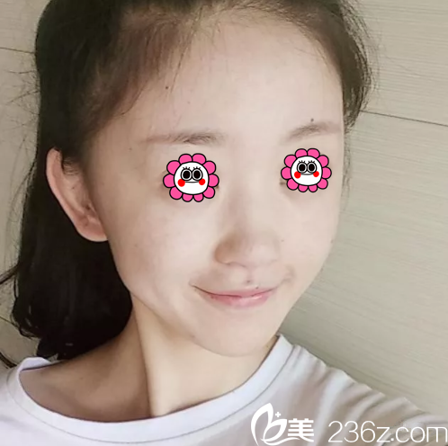 術(shù)前照片 術(shù)前照片