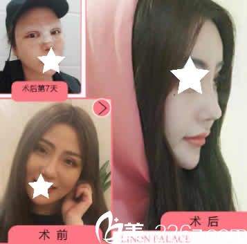 在整理運(yùn)城整形醫(yī)院排名時(shí)發(fā)現(xiàn)藍(lán)山整形2019優(yōu)惠價(jià)格表透露給大家