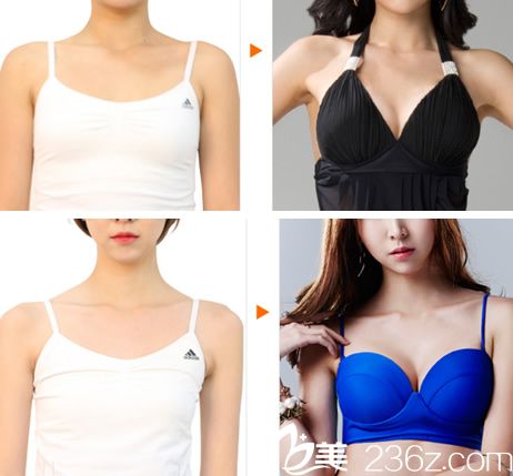 <!--<i data=20240703-sp></i>-->整形周龍?jiān)洪L(zhǎng)隆胸<span style= <!--<i data=20240703-sp></i>-->整形周龍?jiān)洪L(zhǎng)隆胸<span style=