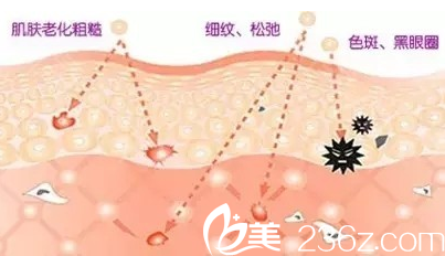 吉林市激光美膚哪好？吉林侯氏激光美膚科2019新年特惠光子嫩膚498元起還你細(xì)嫩肌膚