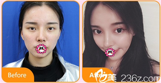 北京藝星醫(yī)療美容醫(yī)院王洛生眼綜合