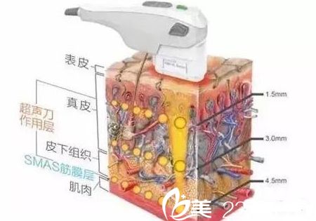 吉林豐滿趙鋼醫(yī)院怎么樣？2019新年整形優(yōu)惠價格公開原價6800元的熱瑪吉現(xiàn)2280元