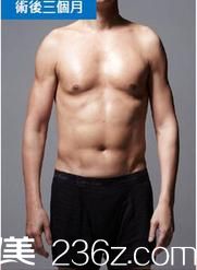 分享我在泰國KAMOL整形美容醫(yī)院的威塑4D吸脂經(jīng)歷，女友夸我男人味十足!