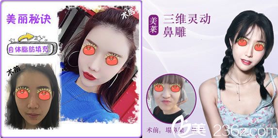 杭州美萊受網(wǎng)紅歡迎的項(xiàng)目 杭州美萊受網(wǎng)紅歡迎的項(xiàng)目